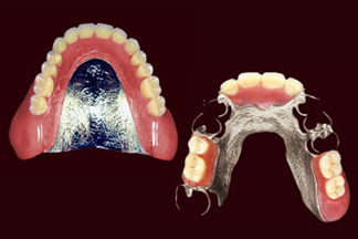 金属床(コバルト)